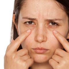 Thermage For Droopy  Eyelids 